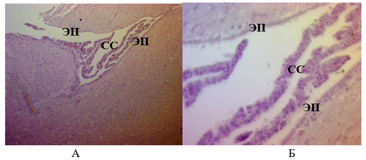 Ткань мозга крысы из опытной группы через 14 суток:А – Ув.´100; Б – Ув.´400