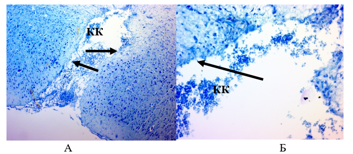 Ткань мозга крысы из контрольной группы через 28 суток:А – Ув.´100; Б – Ув.´400