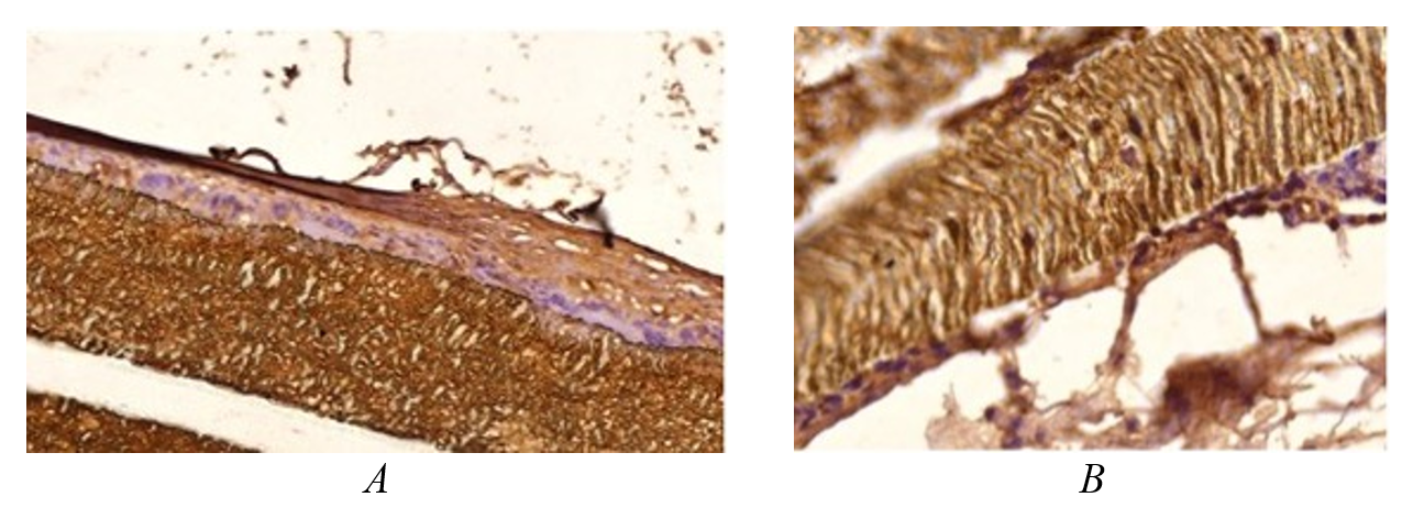 Deposits of fibronectin (A) and type I collagen (B) in the bulk and on the surface of an uncoated polytetrafluoroethylene implant