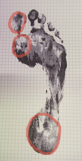 Схема вычисления «пятен контакта» на принтах стопы