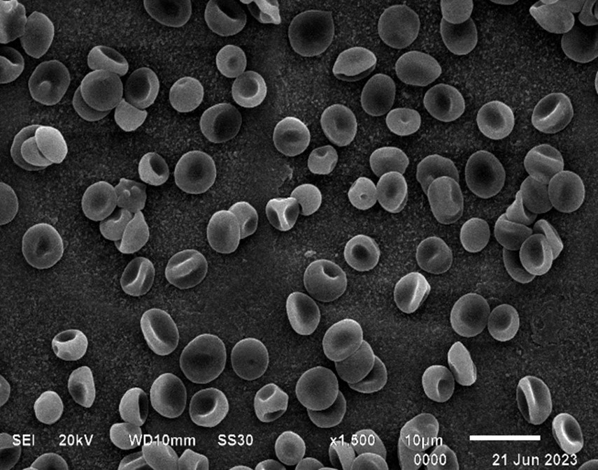Scanning electron micrograph of human erythrocytes