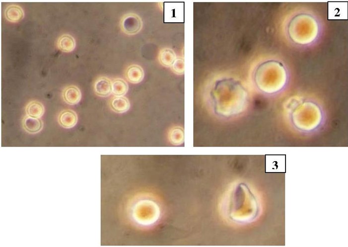 Human erythrocytes in a hypo‑osmotic NaCl solution (0,55 %)