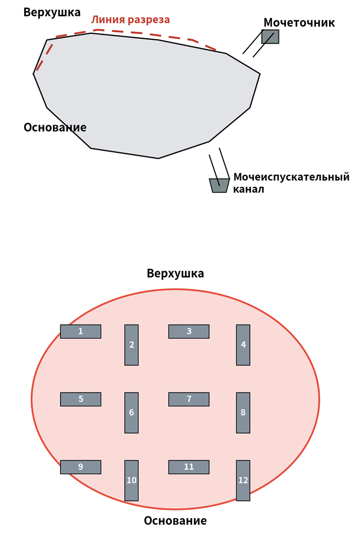 Схема среза образцов из мочевого пузыря человека
